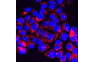 Immunofluorescence (IF) image for anti-Transient Receptor Potential Cation Channel, Subfamily M, Member 7 (TRPM7) (4th Cytoplasmic Loop) antibody (ABIN351218)