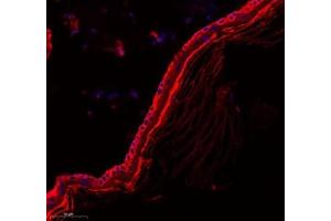 Immunofluorescence of paraffin embedded rat skin using Zdhhc9 (ABIN7076282) at dilution of 1: 700 (300x lens) (ZDHHC9 抗体)