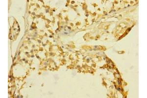 Immunohistochemistry of paraffin-embedded human testis tissue using ABIN7172811 at dilution of 1:100 (TGFBR3 抗体  (AA 140-340))