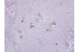 IHC-P Image Immunohistochemical analysis of paraffin-embedded Cal27 xenograft, using PHKA1, antibody at 1:500 dilution. (PHKA1 抗体  (C-Term))