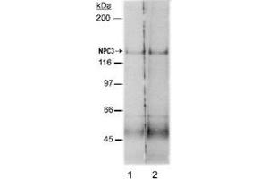 Western blot analysis of Npc1l1 in rat small intestine membrane preparations (Lane 1 : 2 ug/mL , Lane 2 : 4 ug/mL) with Npc1l1 polyclonal antibody . (NPC1L1 抗体  (AA 500-600))