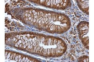 IHC-P Image Selenoprotein P antibody detects Selenoprotein P protein at cytoplasm in human colon by immunohistochemical analysis. (Selenoprotein P 抗体)