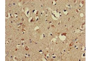 Immunohistochemistry of paraffin-embedded human brain tissue using ABIN7169274 at dilution of 1:100