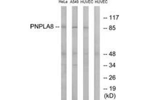Western blot analysis of extracts from HuvEc/HeLa/A549 cells, using PNPLA8 Antibody. (PNPLA8 抗体  (AA 691-740))