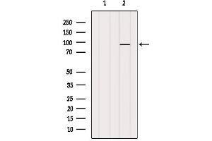 Western blot analysis of extracts from VERO, using MGH1/2 Antibody. (MGH1/2 抗体)