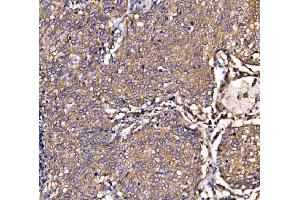 IHC analysis of SCRN1 using anti-SCRN1 antibody (ABIN7602923). (Secernin 1 抗体  (C-Term))