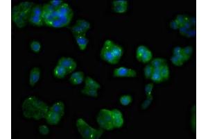 Immunofluorescent analysis of HepG2 cells using ABIN7159794 at dilution of 1:100 and Alexa Fluor 488-congugated AffiniPure Goat Anti-Rabbit IgG(H+L) (MAST3 抗体  (AA 1101-1309))