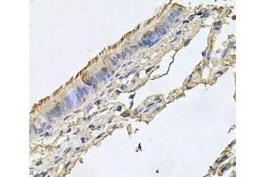 Immunohistochemistry of paraffin-embedded Human trachea using FABP12 Polyclonal Antibody at dilution of 1:100 (40x lens). (FABP12 抗体)