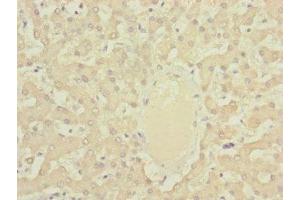 Immunohistochemistry of paraffin-embedded human liver tissue using ABIN7149326 at dilution of 1:100 (DYNC2LI1 抗体  (AA 1-352))