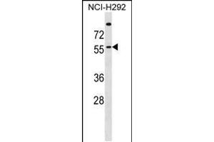 Western blot analysis in NCI-H292 cell line lysates (35ug/lane). (ZDHHC13 抗体  (N-Term))