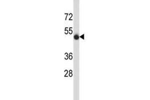 CD43 antibody western blot analysis in MDA-MB435 lysate. (CD43 抗体  (AA 32-60))