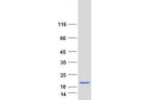 Western Blotting (WB) image for Proteasome (Prosome, Macropain) 26S Subunit, Non-ATPase, 10 (PSMD10) (Transcript Variant 2) protein (Myc-DYKDDDDK Tag) (ABIN2729974)