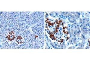 IHC testing of FFPE human pancreas with CCKAR antibody at 10ug/ml. (CCKAR 抗体)