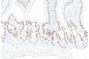 Immunohistochemistry (IHC) image for anti-Kruppel-Like Factor 5 (Intestinal) (KLF5) (AA 325-375) antibody (ABIN7795630) (Recombinant KLF5 抗体  (AA 325-375))
