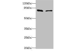 Western blot All lanes: SLC39A6 antibody at 10 μg/mL Lane 1: Hela whole cell lysate Lane 2: 293T whole cell lysate Secondary Goat polyclonal to rabbit IgG at 1/10000 dilution Predicted band size: 86, 49 kDa Observed band size: 86 kDa (SLC39A6 抗体  (AA 170-320))