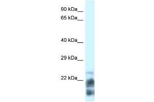 MDP1 antibody used at 1 ug/ml to detect target protein. (MDP1 抗体  (N-Term))