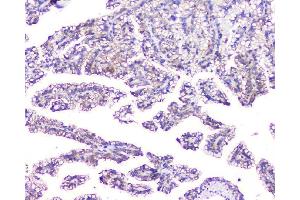 IHC analysis of EVA1A using anti-EVA1A antibody (ABIN6719564). (TMEM166 抗体)