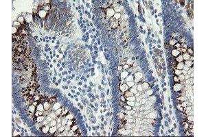 Image no. 3 for anti-Src-like-adaptor 2 (SLA2) antibody (ABIN1500948)
