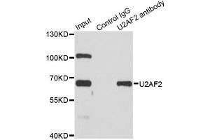 Immunoprecipitation analysis of 200ug extracts of SW620 cells using 1ug U2AF2 antibody. (U2AF2 抗体)