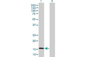 Western Blot analysis of SAT2 expression in transfected 293T cell line by SAT2 MaxPab polyclonal antibody. (SAT2 抗体  (AA 1-170))