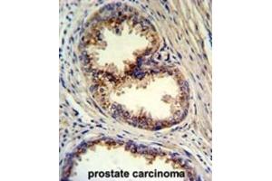 Immunohistochemistry (IHC) image for anti-Golgi phosphoprotein 3 (Coat-Protein) (GOLPH3) antibody (ABIN3003211) (GOLPH3 抗体)