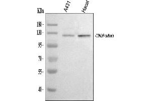 Western blot analysis of P cadherin/CDH3 using anti-P cadherin/CDH3 antibody (ABIN6719500).
