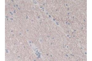IHC-P analysis of Human Brain Tissue, with DAB staining. (IL-8 抗体  (AA 23-101))