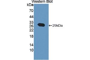 Western blot analysis of the recombinant protein. (ABCA12 抗体  (AA 1346-1577))