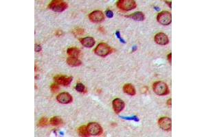 Immunohistochemical analysis of INPP5J staining in human brain formalin fixed paraffin embedded tissue section. (INPP5J 抗体  (C-Term))