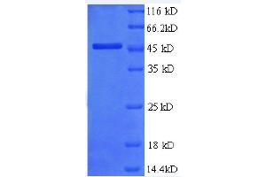 SDS-PAGE (SDS) image for Metalloproteinase Inhibitor 2 (TIMP2) (AA 30-220), (partial) protein (GST tag) (ABIN1095681)