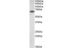 AP32138PU-N PDIA2 antibody staining of Human Pancreas lysate (35µg protein in RIPA buffer). (PDIA2 抗体  (Internal Region))