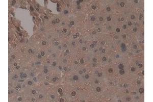 DAB staining on IHC-P; Samples: Mouse Liver Tissue (TNP1 抗体  (AA 3-53))