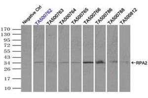 Image no. 5 for anti-Replication Protein A2, 32kDa (RPA2) antibody (ABIN1500738) (RPA2 抗体)
