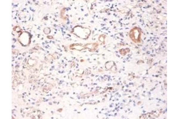 Pyruvate Kinase, Muscle (PKM) 抗体
