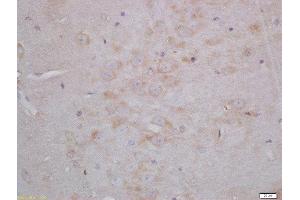 Formalin-fixed and paraffin embedded rat brain tissue labeled with Anti-Neurogranin Polyclonal Antibody, Unconjugated(ABIN1387517) 1:200, followed by conjugation to the secondary antibody and DAB. (Neurogranin 抗体  (AA 30-78))