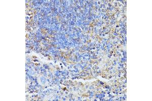 Immunohistochemistry of paraffin-embedded mouse spleen using STK24 antibody (ABIN6132364, ABIN6148602, ABIN6148603 and ABIN6214875) at dilution of 1:100 (40x lens). (STK24 抗体  (AA 312-431))