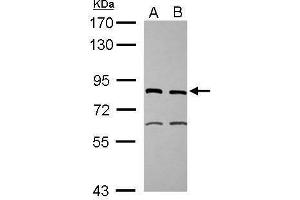 WB Image Sample (30 ug of whole cell lysate) A: IMR32 B: U87-MG 7. (ERCC2 抗体  (Internal Region))