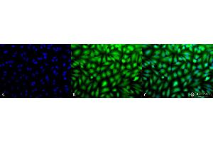 Immunocytochemistry/Immunofluorescence analysis using Rabbit Anti-Erk1/2 Polyclonal Antibody . (ERK1 抗体  (Biotin))