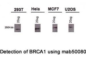 Image no. 2 for anti-Breast Cancer 1 (BRCA1) (AA 1314-1600), (AA 1314-1864) antibody (ABIN363234) (BRCA1 抗体  (AA 1314-1600, AA 1314-1864))