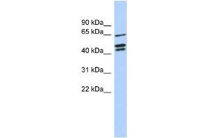 WB Suggested Anti-ZNF578 Antibody Titration:  0. (ZNF578 抗体  (N-Term))