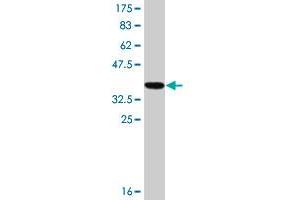 Western Blot detection against Immunogen (36. (RAB1A 抗体  (AA 106-204))