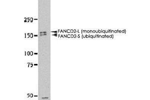 Western blot analysis of FANCD2 in HeLa whole cell extract using FANCD2 polyclonal antibody . (FANCD2 抗体  (N-Term))