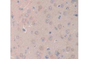 IHC-P analysis of Rat Tissue, with DAB staining. (IL1R1 抗体  (AA 226-352))
