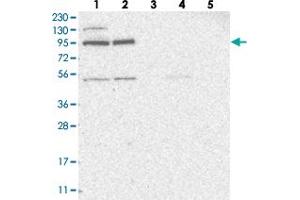 Western blot analysis of Lane 1: RT-4, Lane 2: U-251 MG, Lane 3: Human Plasma, Lane 4: Liver, Lane 5: Tonsil with ZNF341 polyclonal antibody  at 1:250-1:500 dilution. (ZNF341 抗体)