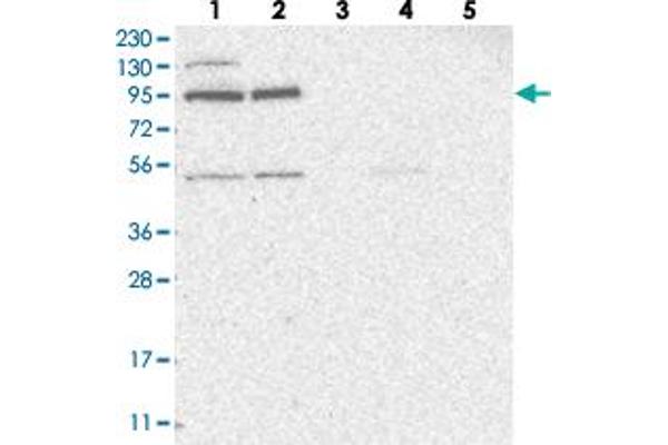 ZNF341 anticorps