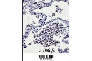 CYSLTR1 Antibody immunohistochemistry analysis in formalin fixed and paraffin embedded human lung tissue followed by peroxidase conjugation of the secondary antibody and DAB staining. (CysLTR1 抗体  (AA 144-172))