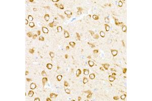 Immunohistochemistry (IHC) image for anti-Ubiquitin Specific Peptidase 18 (USP18) (AA 200-300) antibody (ABIN7271145)