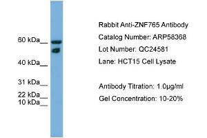 WB Suggested Anti-ZNF765  Antibody Titration: 0. (ZNF765 抗体  (N-Term))
