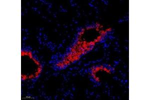 Immunofluorescence (Paraffin-embedded Sections) (IF (p)) image for anti-ATPase, H+ Transporting, Lysosomal 42kDa, V1 Subunit C2 (ATP6V1C2) antibody (ABIN7073157)