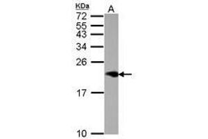 Image no. 1 for anti-Niemann-Pick Disease, Type C2 (NPC2) (AA 1-151) antibody (ABIN1499802) (NPC2 抗体  (AA 1-151))